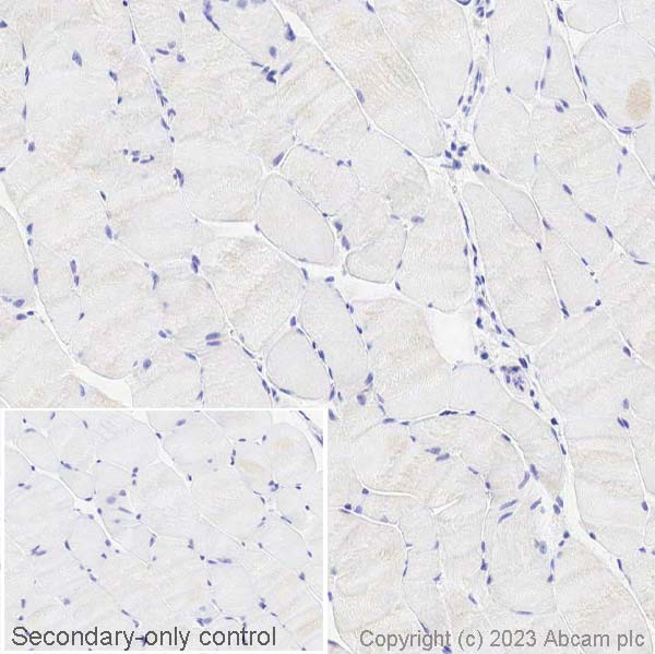 Immunohistochemistry (Formalin/PFA-fixed paraffin-embedded sections) - Anti-Sall4 antibody (ab29112), expandable thumbnail
