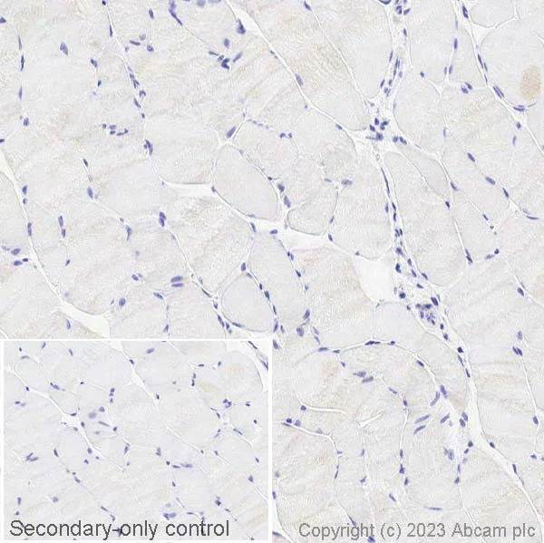 Immunohistochemistry (Formalin/PFA-fixed paraffin-embedded sections) - Anti-Sall4 antibody (AB29112)