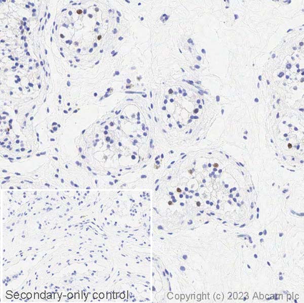 Immunohistochemistry (Formalin/PFA-fixed paraffin-embedded sections) - Anti-Sall4 antibody (ab29112), expandable thumbnail