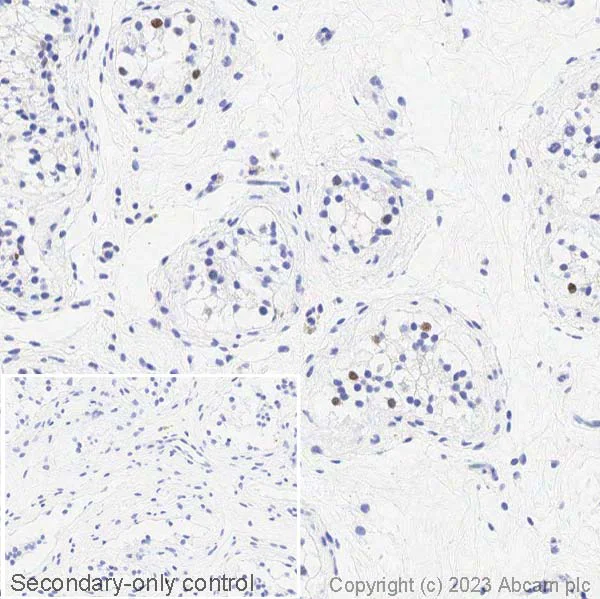 Immunohistochemistry (Formalin/PFA-fixed paraffin-embedded sections) - Anti-Sall4 antibody (AB29112)