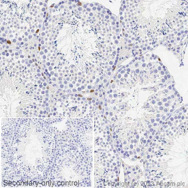 Immunohistochemistry (Formalin/PFA-fixed paraffin-embedded sections) - Anti-Sall4 antibody (AB29112)