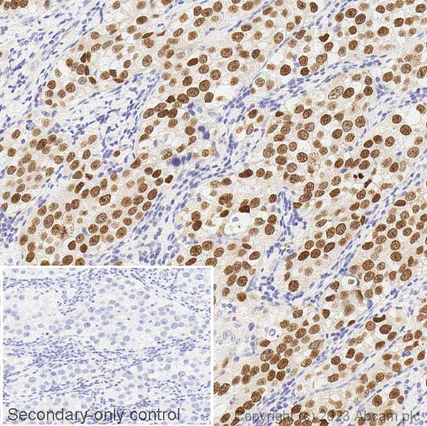 Immunohistochemistry (Formalin/PFA-fixed paraffin-embedded sections) - Anti-Sall4 antibody (AB29112), expandable thumbnail