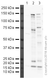 Western blot - Anti-Sall4 antibody (AB29112), expandable thumbnail