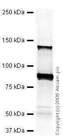 Western blot - Anti-Sall4 antibody (ab29112), expandable thumbnail