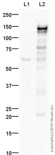 Western blot - Anti-Sall4 antibody (AB29112), expandable thumbnail