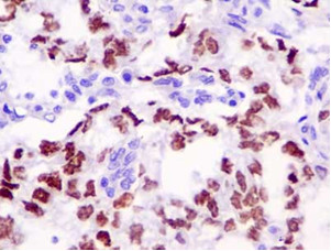 Immunohistochemistry (Formalin/PFA-fixed paraffin-embedded sections) - Anti-Sall4 antibody [EPR10642] (AB181087)