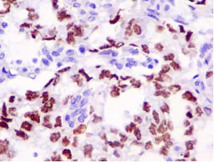 Immunohistochemistry (Formalin/PFA-fixed paraffin-embedded sections) - Anti-Sall4 antibody [EPR10642] - BSA and Azide free (AB250336)