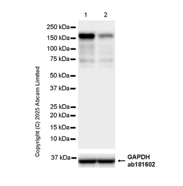 Western blot - Anti-Sall4 antibody [EPR27142-83] (AB324483)