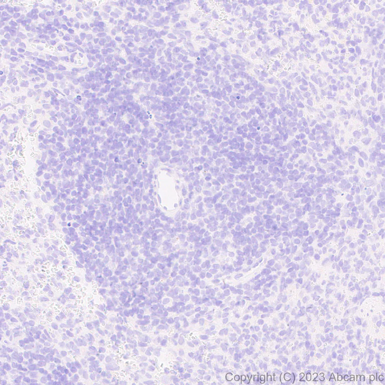 Immunohistochemistry (Formalin/PFA-fixed paraffin-embedded sections) - Anti-Sall4 antibody [EPR27143-83] (AB308629)