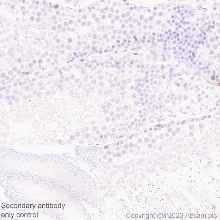 Immunohistochemistry (Formalin/PFA-fixed paraffin-embedded sections) - Anti-Sall4 antibody [EPR27143-83] (AB308629)