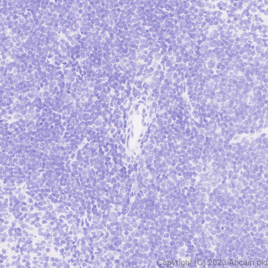 Immunohistochemistry (Formalin/PFA-fixed paraffin-embedded sections) - Anti-Sall4 antibody [EPR27143-83] - BSA and Azide free (AB308630), expandable thumbnail