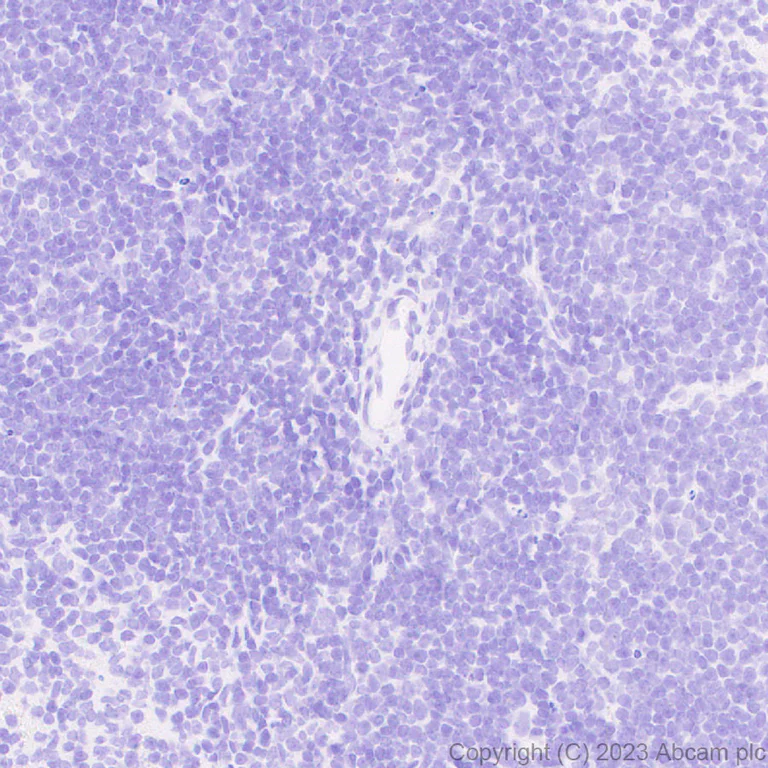 Immunohistochemistry (Formalin/PFA-fixed paraffin-embedded sections) - Anti-Sall4 antibody [EPR27143-83] - BSA and Azide free (AB308630)