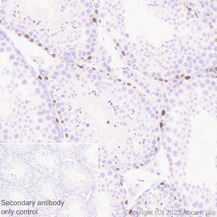 Immunohistochemistry (Formalin/PFA-fixed paraffin-embedded sections) - Anti-Sall4 antibody [EPR27143-83] - BSA and Azide free (AB308630), expandable thumbnail