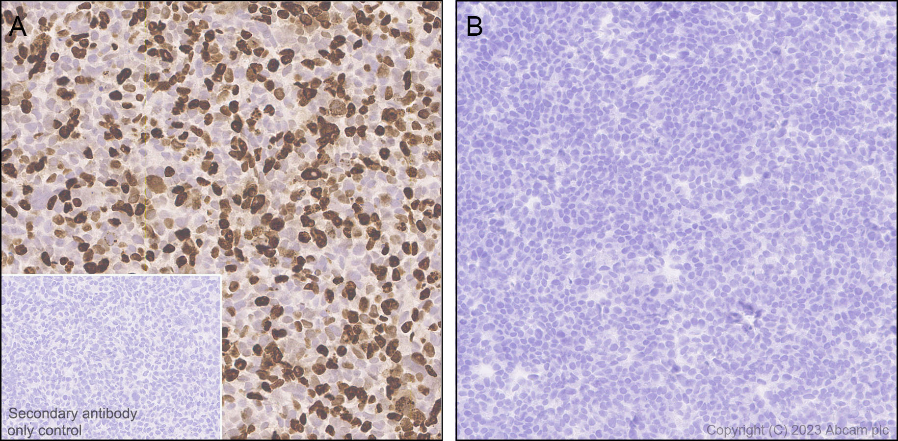 Immunohistochemistry (Formalin/PFA-fixed paraffin-embedded sections) - Anti-Sall4 antibody [EPR27143-83] - BSA and Azide free (AB308630), expandable thumbnail