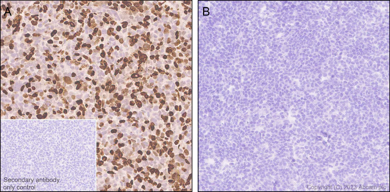 Immunohistochemistry (Formalin/PFA-fixed paraffin-embedded sections) - Anti-Sall4 antibody [EPR27143-83] - BSA and Azide free (AB308630)