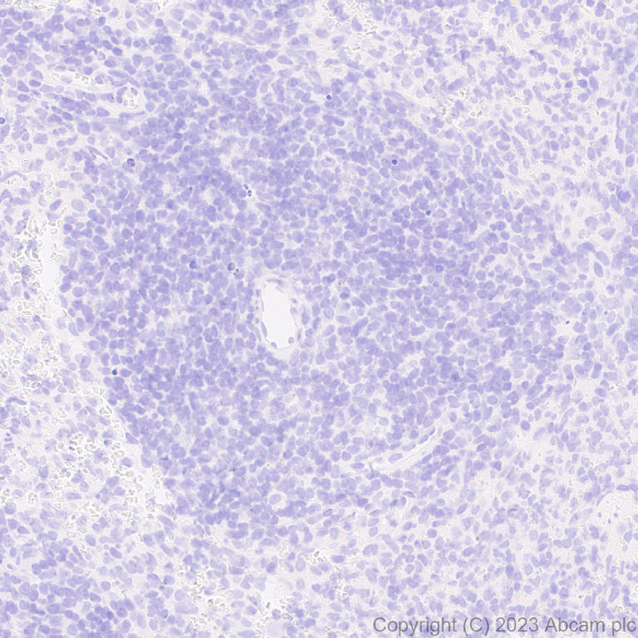 Immunohistochemistry (Formalin/PFA-fixed paraffin-embedded sections) - Anti-Sall4 antibody [EPR27143-83] - BSA and Azide free (AB308630), expandable thumbnail