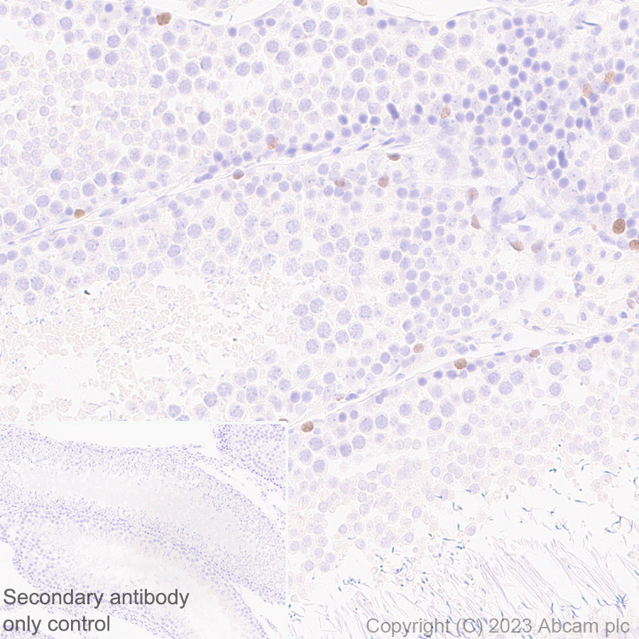 Immunohistochemistry (Formalin/PFA-fixed paraffin-embedded sections) - Anti-Sall4 antibody [EPR27143-83] - BSA and Azide free (AB308630), expandable thumbnail