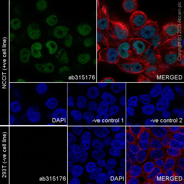 Immunocytochemistry/ Immunofluorescence - Anti-Sall4 antibody [RM1097] - BSA and Azide free (AB315177)