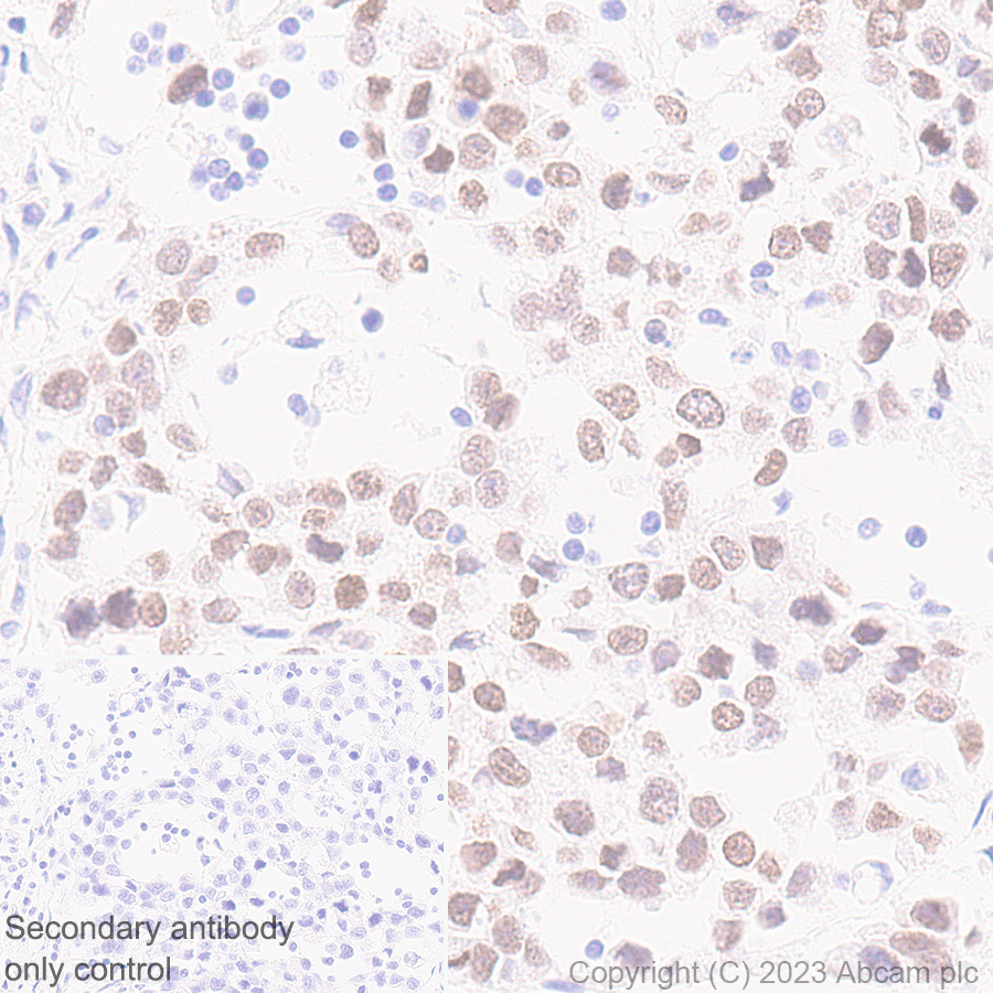 Immunohistochemistry (Formalin/PFA-fixed paraffin-embedded sections) - Anti-Sall4 antibody [RM1097] - BSA and Azide free (ab315177), expandable thumbnail