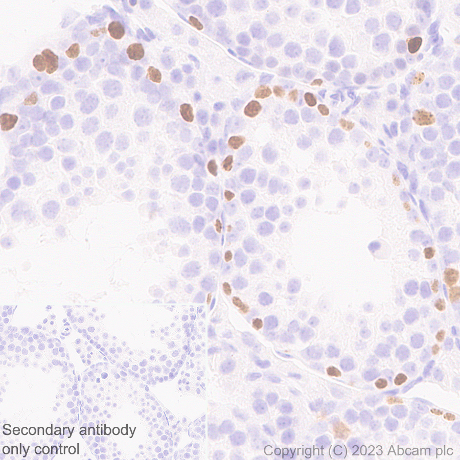 Immunohistochemistry (Formalin/PFA-fixed paraffin-embedded sections) - Anti-Sall4 antibody [RM1097] - BSA and Azide free (AB315177), expandable thumbnail
