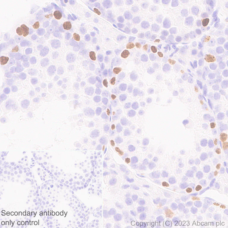 Immunohistochemistry (Formalin/PFA-fixed paraffin-embedded sections) - Anti-Sall4 antibody [RM1097] - BSA and Azide free (AB315177)