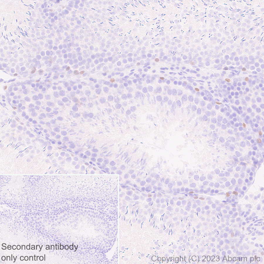 Immunohistochemistry (Formalin/PFA-fixed paraffin-embedded sections) - Anti-Sall4 antibody [RM1097] - BSA and Azide free (AB315177), expandable thumbnail