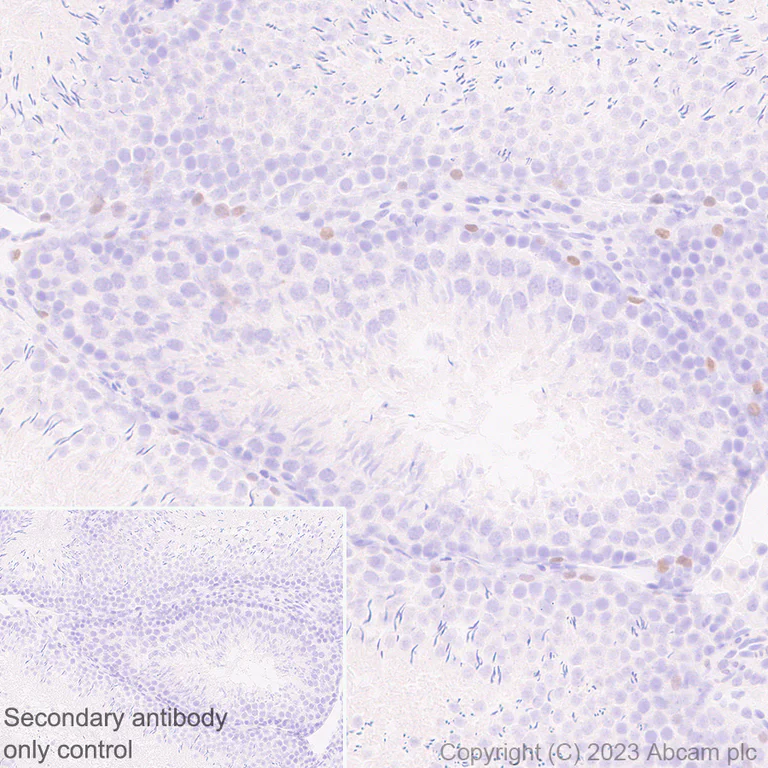 Immunohistochemistry (Formalin/PFA-fixed paraffin-embedded sections) - Anti-Sall4 antibody [RM1097] - BSA and Azide free (AB315177)
