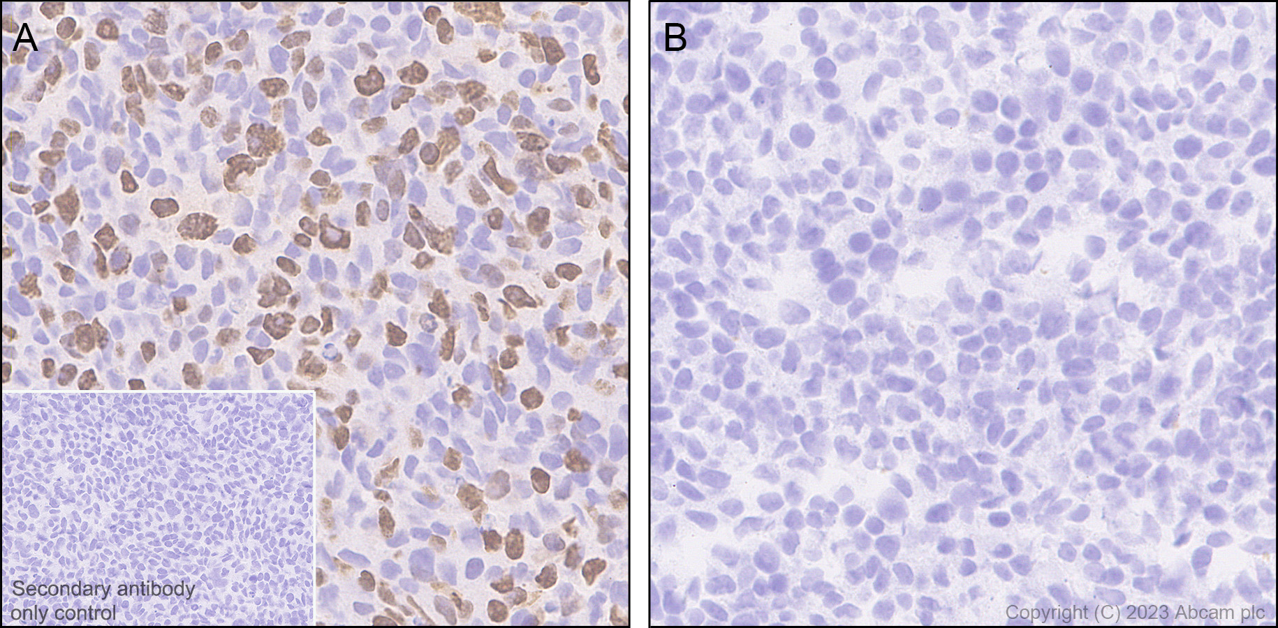 Immunohistochemistry (Formalin/PFA-fixed paraffin-embedded sections) - Anti-Sall4 antibody [RM1097] - BSA and Azide free (AB315177), expandable thumbnail