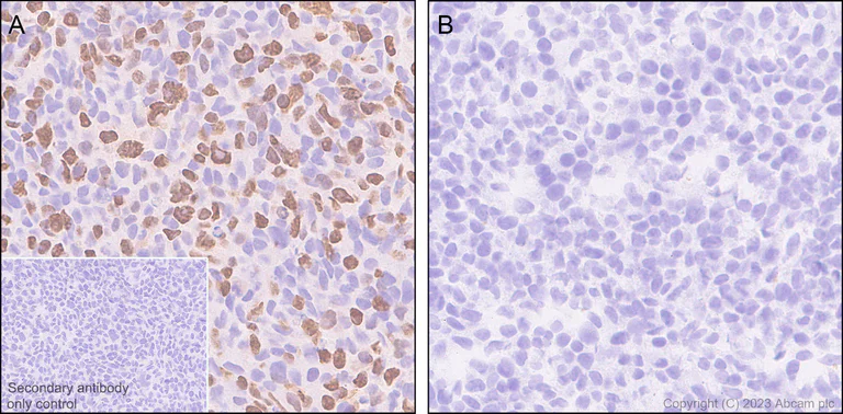 Immunohistochemistry (Formalin/PFA-fixed paraffin-embedded sections) - Anti-Sall4 antibody [RM1097] - BSA and Azide free (AB315177)