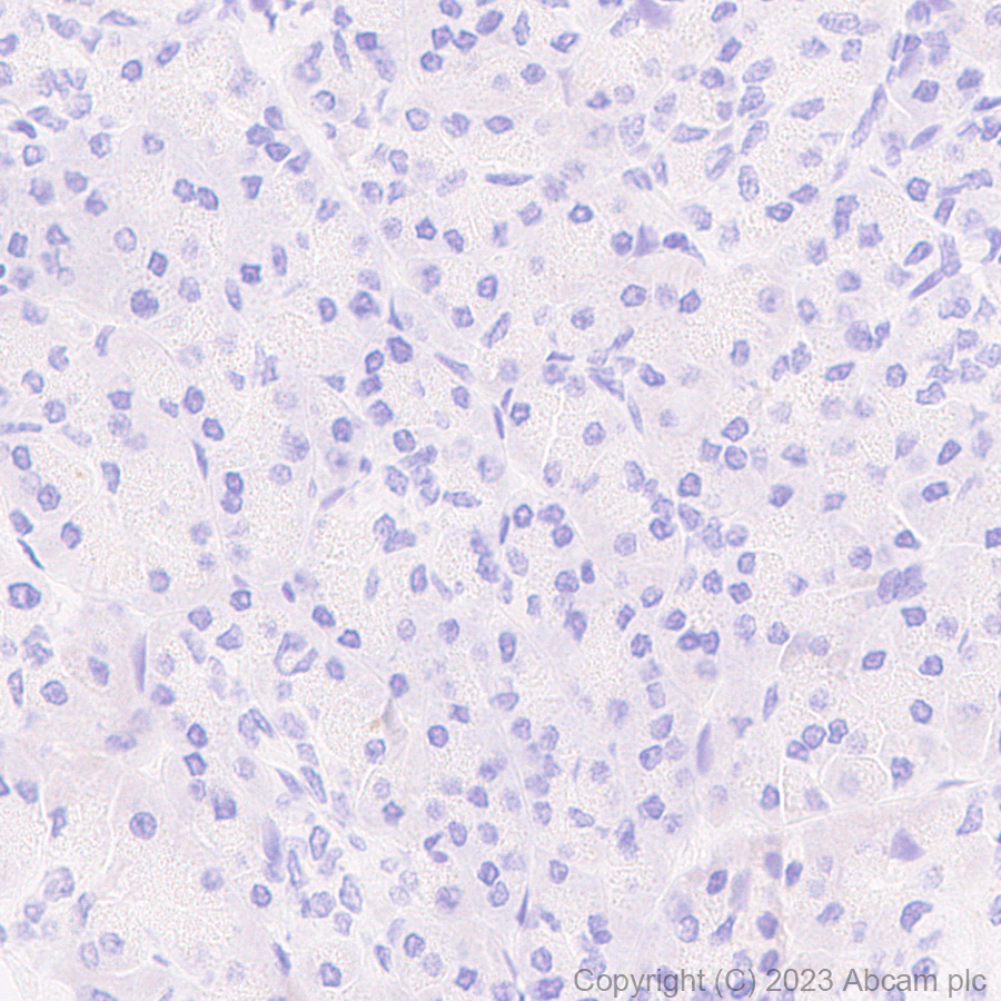Immunohistochemistry (Formalin/PFA-fixed paraffin-embedded sections) - Anti-Sall4 antibody [RM1097] - BSA and Azide free (AB315177), expandable thumbnail