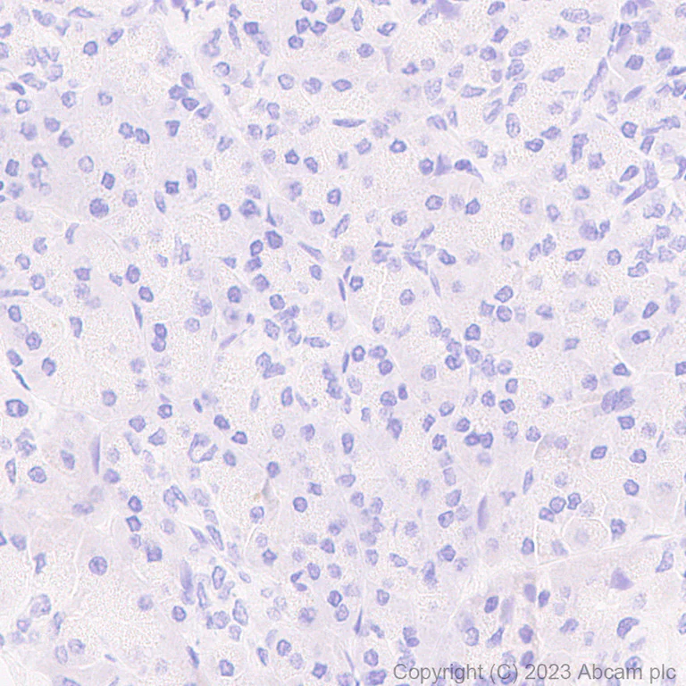 Immunohistochemistry (Formalin/PFA-fixed paraffin-embedded sections) - Anti-Sall4 antibody [RM1097] - BSA and Azide free (AB315177)