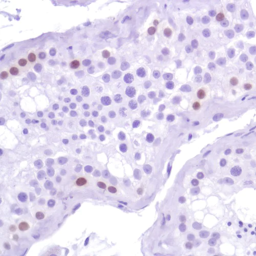 Immunohistochemistry (Formalin/PFA-fixed paraffin-embedded sections) - Anti-Sall4 antibody [SP289] - BSA and Azide free (AB245759)