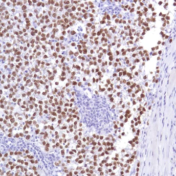 Immunohistochemistry (Formalin/PFA-fixed paraffin-embedded sections) - Anti-Sall4 antibody [SP289] - BSA and Azide free (AB245759)