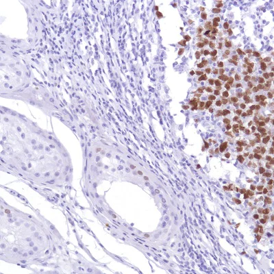 Immunohistochemistry (Formalin/PFA-fixed paraffin-embedded sections) - Anti-Sall4 antibody [SP289] - BSA and Azide free (AB245759)