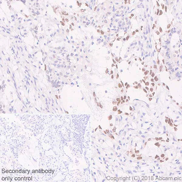 Immunohistochemistry (Formalin/PFA-fixed paraffin-embedded sections) - Anti-Sall4 antibody [SP289] - BSA and Azide free (AB245759)