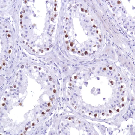 Immunohistochemistry (Formalin/PFA-fixed paraffin-embedded sections) - Anti-Sall4 antibody [SP289] - BSA and Azide free (AB245759)