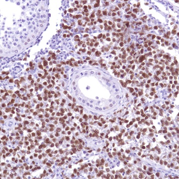 Immunohistochemistry (Formalin/PFA-fixed paraffin-embedded sections) - Anti-Sall4 antibody [SP289] - BSA and Azide free (AB245759)