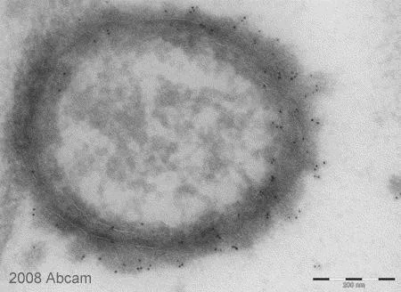 Electron Microscopy - Anti-Salmonella typhimurium LPS antibody [1E6] (AB8274)