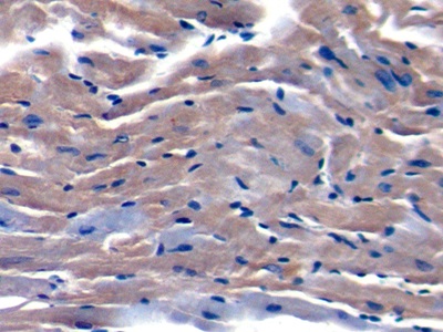 Immunohistochemistry (Formalin/PFA-fixed paraffin-embedded sections) - Anti-Salusin alpha antibody (AB232928), expandable thumbnail
