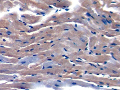 Immunohistochemistry (Formalin/PFA-fixed paraffin-embedded sections) - Anti-Salusin alpha antibody (AB232928)