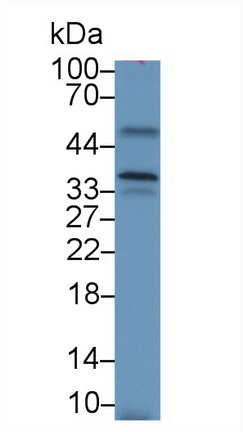 Western blot - Anti-Salusin alpha antibody (AB232928), expandable thumbnail
