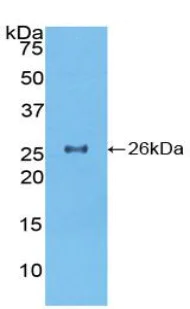 Western blot - Anti-Salusin alpha antibody (AB232928)