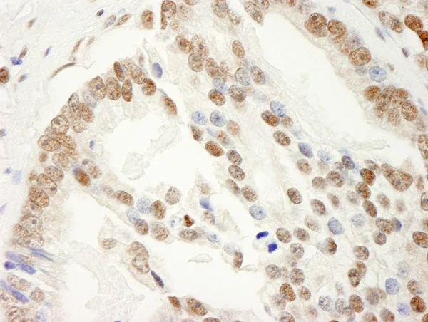 Immunohistochemistry (Formalin/PFA-fixed paraffin-embedded sections) - Anti-SAM68 antibody (AB86239)