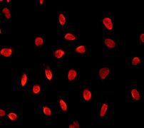 Immunocytochemistry/ Immunofluorescence - Anti-SAM68 antibody [EPR3231] (AB76471)