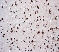 Immunohistochemistry (Formalin/PFA-fixed paraffin-embedded sections) - Anti-SAM68 antibody [EPR3231] (AB76471)