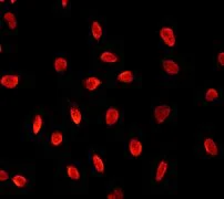 Immunocytochemistry/ Immunofluorescence - Anti-SAM68 antibody [EPR3231] - BSA and Azide free (AB247478)