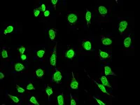 Immunocytochemistry/ Immunofluorescence - Anti-SAM68 antibody [EPR3232] (AB109197)