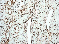 Immunohistochemistry (Formalin/PFA-fixed paraffin-embedded sections) - Anti-SAM68 antibody [EPR3232] (AB109197), expandable thumbnail