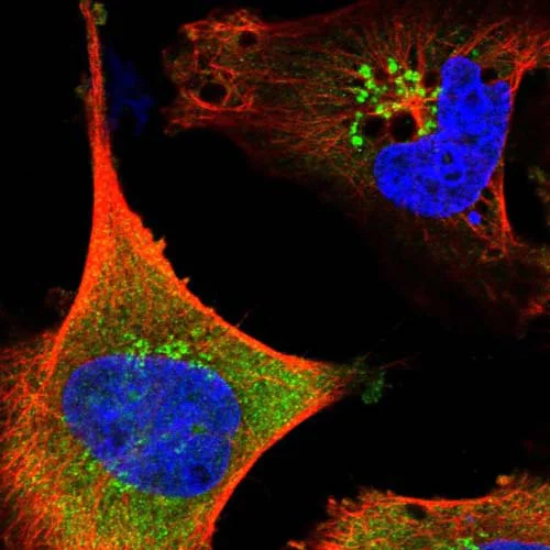 Immunocytochemistry/ Immunofluorescence - Anti-SAMD12 antibody (AB121831)