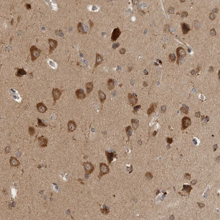 Immunohistochemistry (Formalin/PFA-fixed paraffin-embedded sections) - Anti-SAMD12 antibody (AB121831)